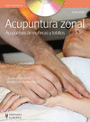 ACUPUNTURA ZONAL DE MUECAS Y TOBILLOS